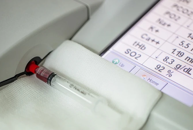 Routine coagulation tests